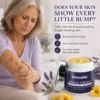 Vrerudite™ Bruise Repair & Skin — Strengthening Cream
